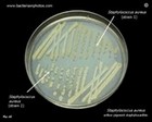 Staphylococcus aureus yellow pigment